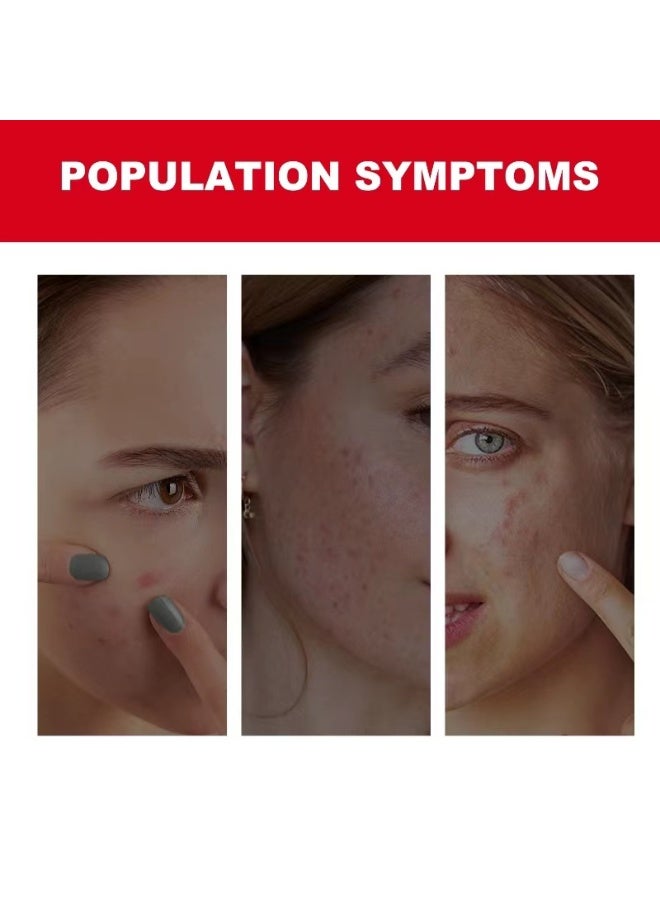 Acne Pimple Patch (24)  Hydrocolloid Acne Absorbing Invisible Zits Spot Patches For Skin Care, Spot Stickers for Face and Body - Image 2