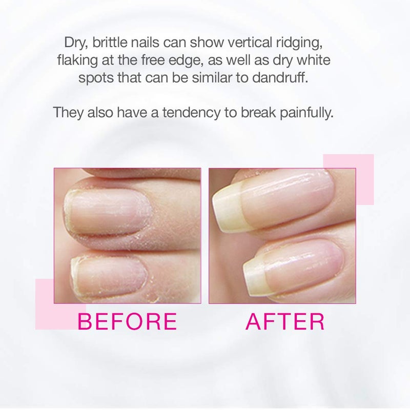 Nail Tek Foundation 3, Ridge Filling Strengthening Base Coat for Hard and Brittle Nails, 0.5 oz, 2-Pack - Image 2