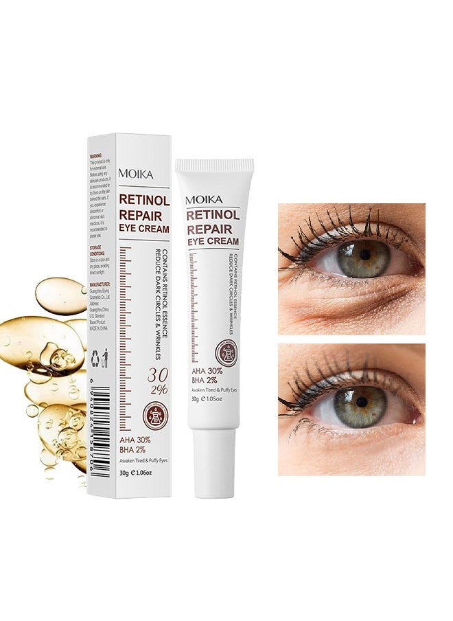 MOIKA - Retinol Repair Eye Cream-For Dark Circles and Puffiness,  with AHA and BHA Dark Circle Fine Lines Treatment,Anti-aging, Under Eye Treatment,Reduces Wrinkles, Defoams and Brightens Skin 30g - Image 1