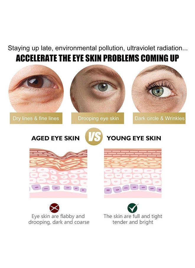 MOIKA - Retinol Repair Eye Cream-For Dark Circles and Puffiness,  with AHA and BHA Dark Circle Fine Lines Treatment,Anti-aging, Under Eye Treatment,Reduces Wrinkles, Defoams and Brightens Skin 30g - Image 1