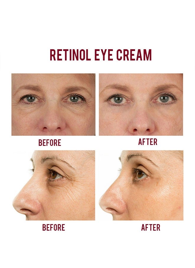 MOIKA - Retinol Repair Eye Cream-For Dark Circles and Puffiness,  with AHA and BHA Dark Circle Fine Lines Treatment,Anti-aging, Under Eye Treatment,Reduces Wrinkles, Defoams and Brightens Skin 30g - Image 1