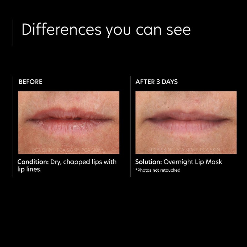 PCA SKIN Overnight Lip Balm Mask â€” Ultra-Moisturizing Lip Skin Care Treatment, Restores Moisture & Hydrates Dry, Chapped Lips while Sleeping (0.46 oz) - Image 4