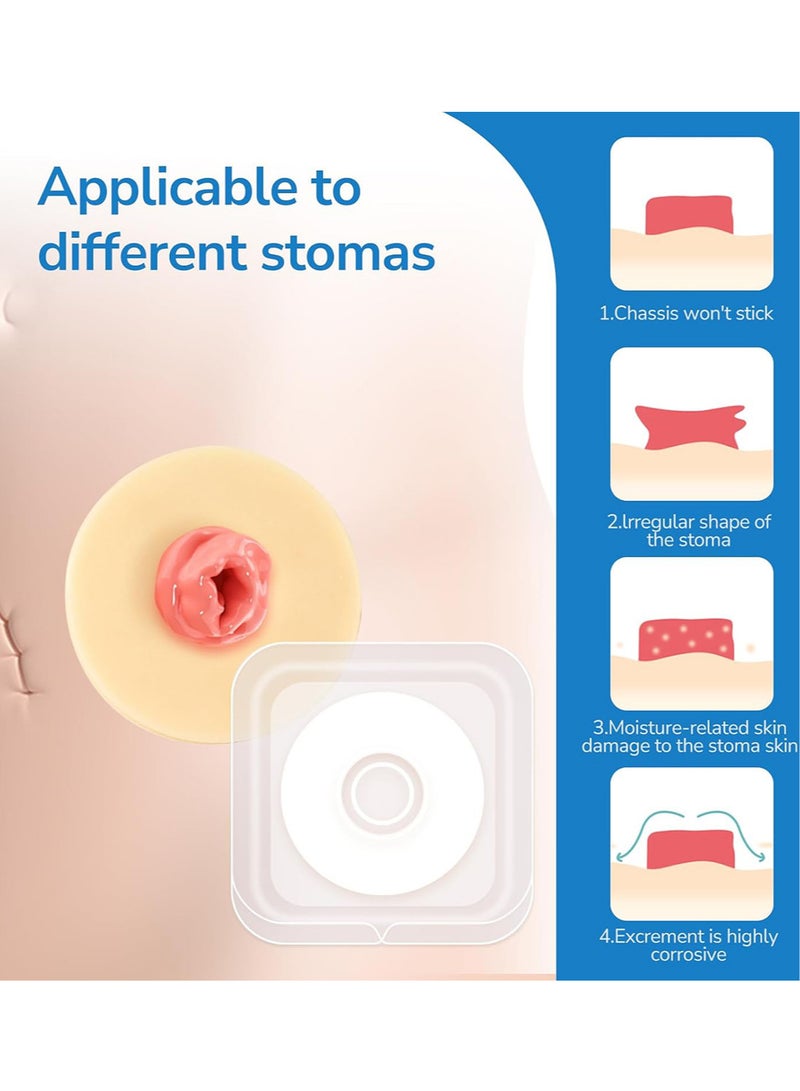 Generic 10pcs Ostomy Barrier Rings, Ostomy Supplies, 2mm or 4mm Thickness Moldable Ostomy Rings Hydrocolloid Adhesive Skin Extender Rings for Colostomy Bags  - Image 4