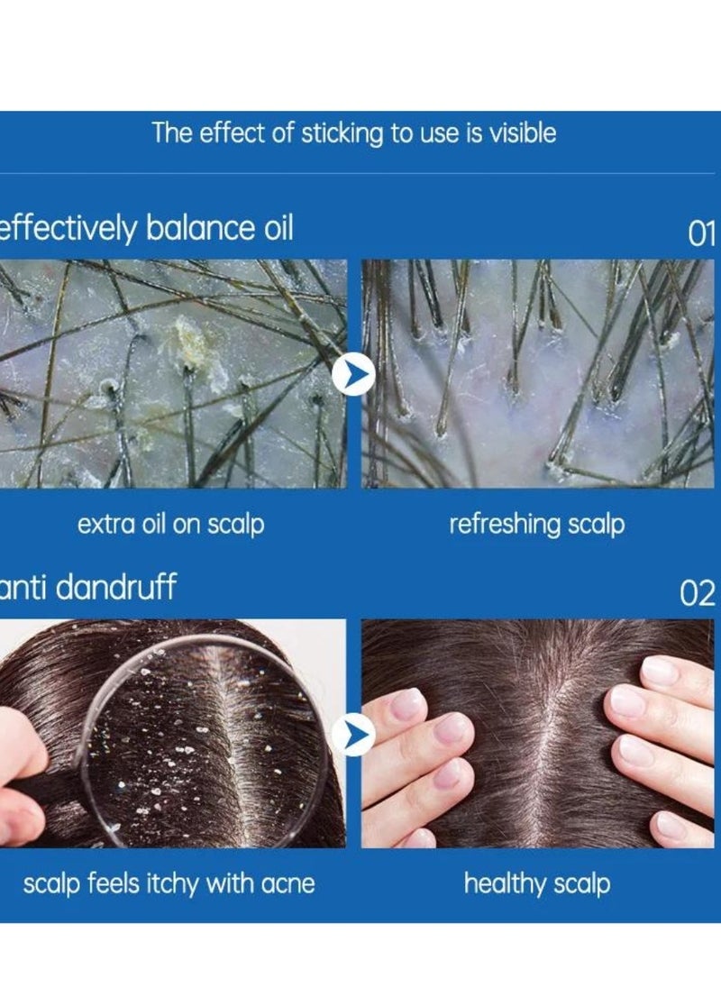 PURC - 60ml Scalp Treatment Essence Spray Activating Scalp Treatment Essence Spray for Relieve Nourish Scalp and Hair Growth Improve Itchy Dry Scalp Biotin Strengthening Hair Root Serum - Image 1