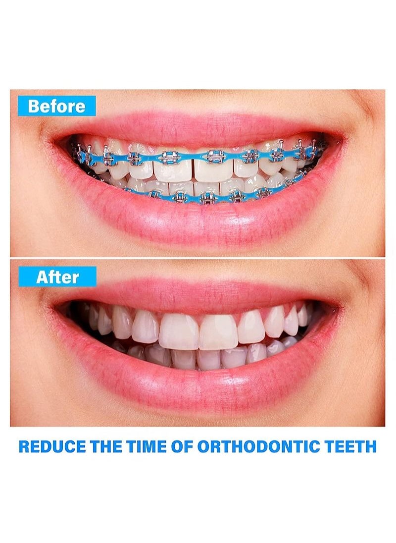 HaLunhi - 2 Rolls Of 2.28m Each Orthodontic Braces Rubber Chain，The Braces Dynamic Chain Consists Of A Short Filament Chain (Short，0.136 in (3.3 mm)，Prussian Blue) - Image 1