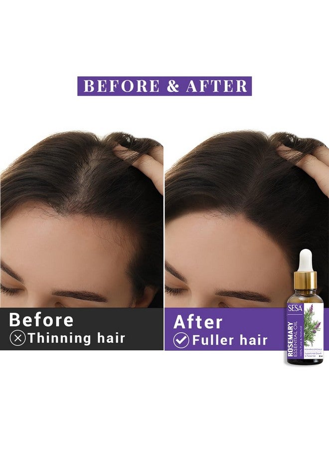 Sesa Rosemary Essential Oil For Hair Growth Nourishes Skin Hair Fall Control Oil For Women And Men 100% Pure & Natural Rosemary Oil, 30 Ml - Image 4