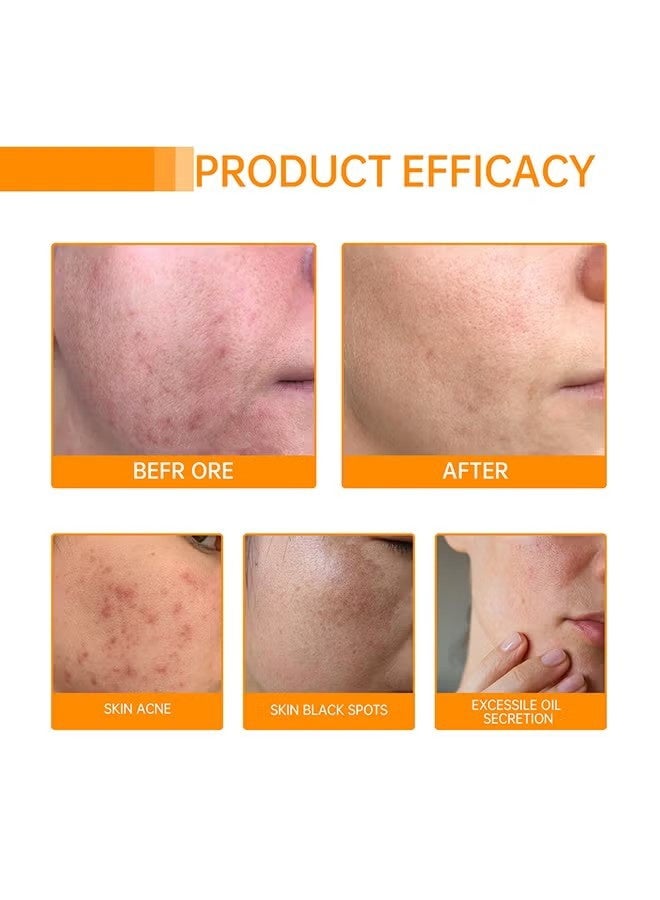 MOIKA Kojic Acid & Turmeric Cleansing Pads for Dark Spots Turmeric Kojic Acid Cleansing Pads Helps Balance Skin Oil & Water Fade Spot Remove Excess Keratin Clean Oil Refines Pores - 50Pcs - Image 2