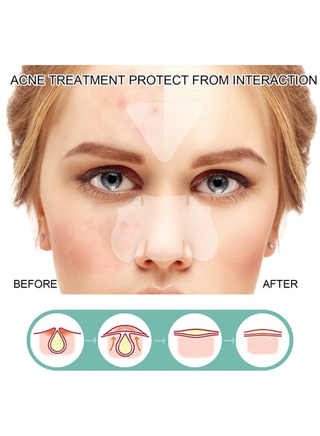 إيلهو بقع حب الشباب ، 5 أحجام 132 بقع بثرة للوجه أو الذقن أو الجسم ، علاج حب الشباب بشجرة الشاي وحمض الساليسيليك ، ضمادات غروانية مائية لبشرة حب الشباب - Image 2