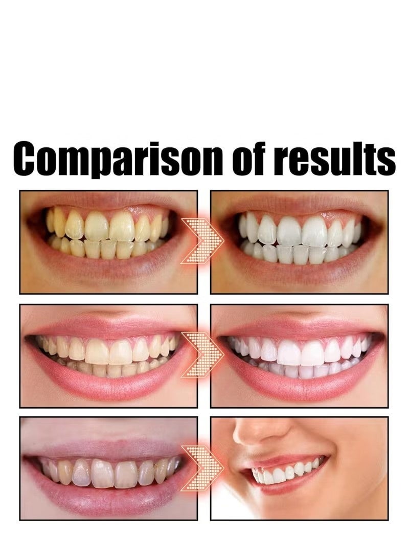 أس بي سوبر تبييض معجون الأسنان - Image 4