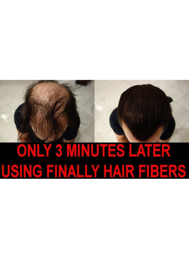 Finally Hair Hair Fiber Sprayer Atomizer 2Nd Generation Larger Anticlog Nozzle Over 10000 Sold For Finally Hair Toppik Miracle Hair Xfusion Luxe N'Hance Instant Hair Bold Hair Thickness Cuuva  - Image 3