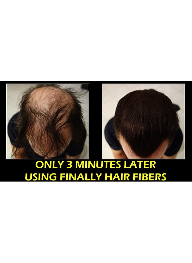 Finally Hair Hair Fiber Sprayer Atomizer 2Nd Generation Larger Anticlog Nozzle Over 10000 Sold For Finally Hair Toppik Miracle Hair Xfusion Luxe N'Hance Instant Hair Bold Hair Thickness Cuuva  - Image 4