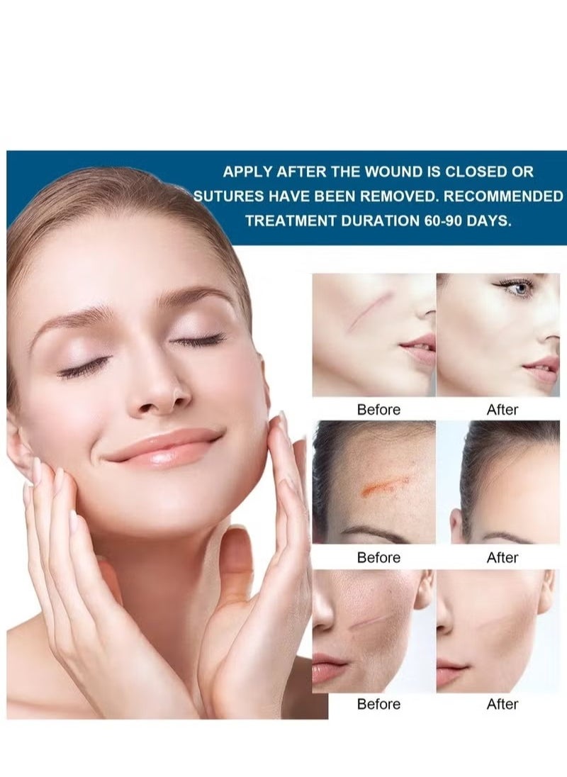 Elaimei Professional Silicone Patch for Burn Skin Facial Repair, Plastic Surgery Scar, Transparent Acne Scar Roller, Scar Removal Sheet  - Image 3
