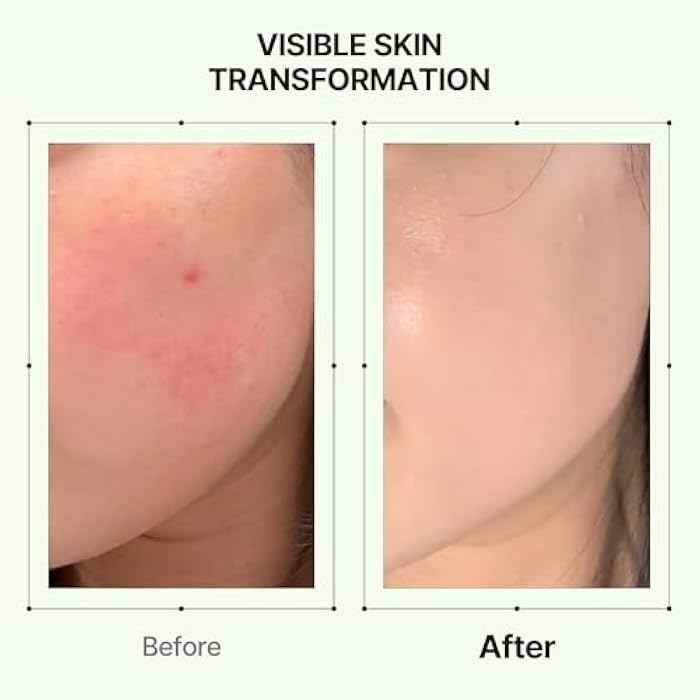 Orien Mugwort Zero Film Moisturizer 60ml Niacinamide 2% panthenol glycerin adenosine - Image 5