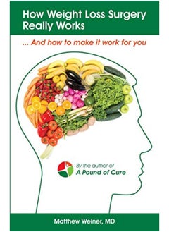 How Weight Loss Surgery Really Works: And How to Make it Work for You