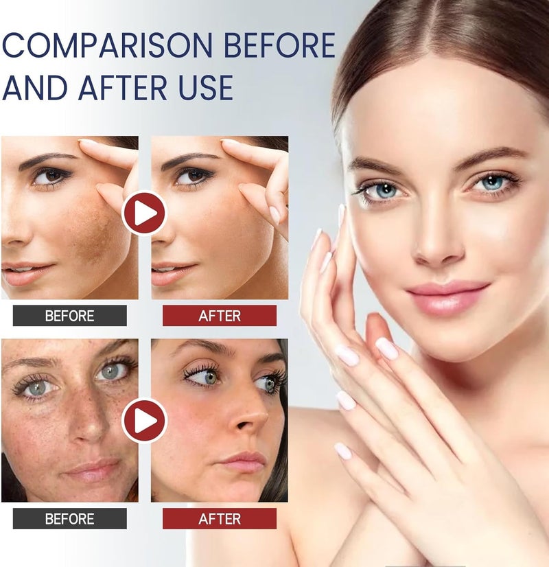 477 Symnanowhite Body Cream with Kojic Acid Hyaluronic Acid Daily Moisturizer for Face Body Suitable for All Skin Types Deeply Nourishing for Smooth Soft Skin 100g - Image 2