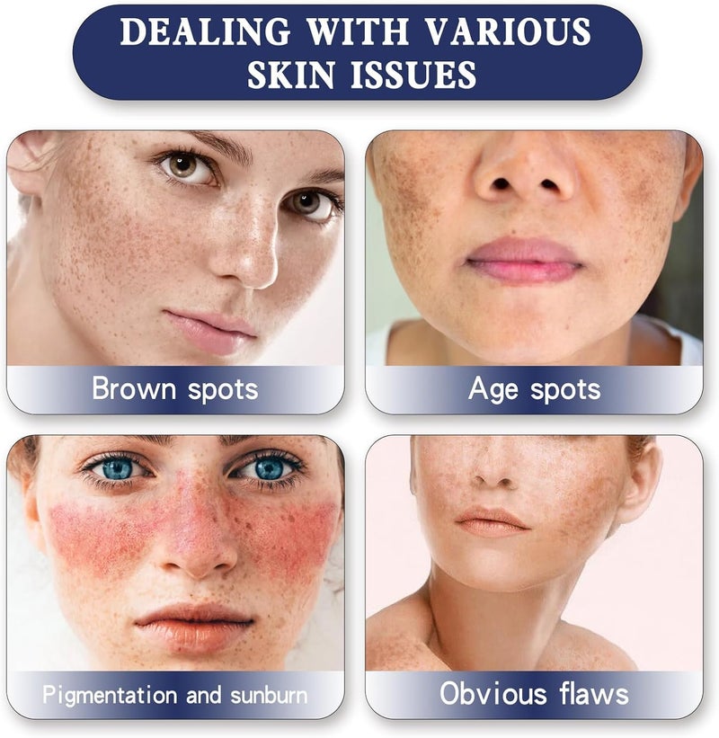 477 Symnanowhite Body Cream with Kojic Acid Hyaluronic Acid Daily Moisturizer for Face Body Suitable for All Skin Types Deeply Nourishing for Smooth Soft Skin 100g - Image 5