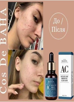 Cos De BAHA Cos De BAHA Azelaic Acid Hinokitiol Clear Skin Serum 30ml  - Image 3