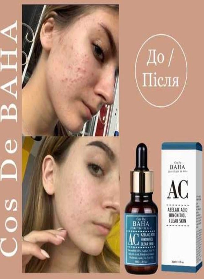Cos De BAHA Cos De BAHA Azelaic Acid Hinokitiol Clear Skin Serum 30ml  - Image 3