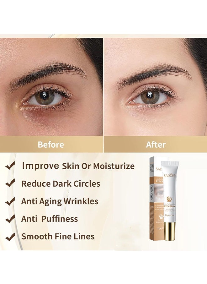 SADOER - Snail Essence Moisturize Eye Cream 20g, Anti Aging, Exquisitely Repair Skin, Moisturize, Fade Eye Lines, Dark Circles and Black Spots, Shrink Pores and Tighten Skin, Moisturizing Eye Serum, Eye Care - Image 1