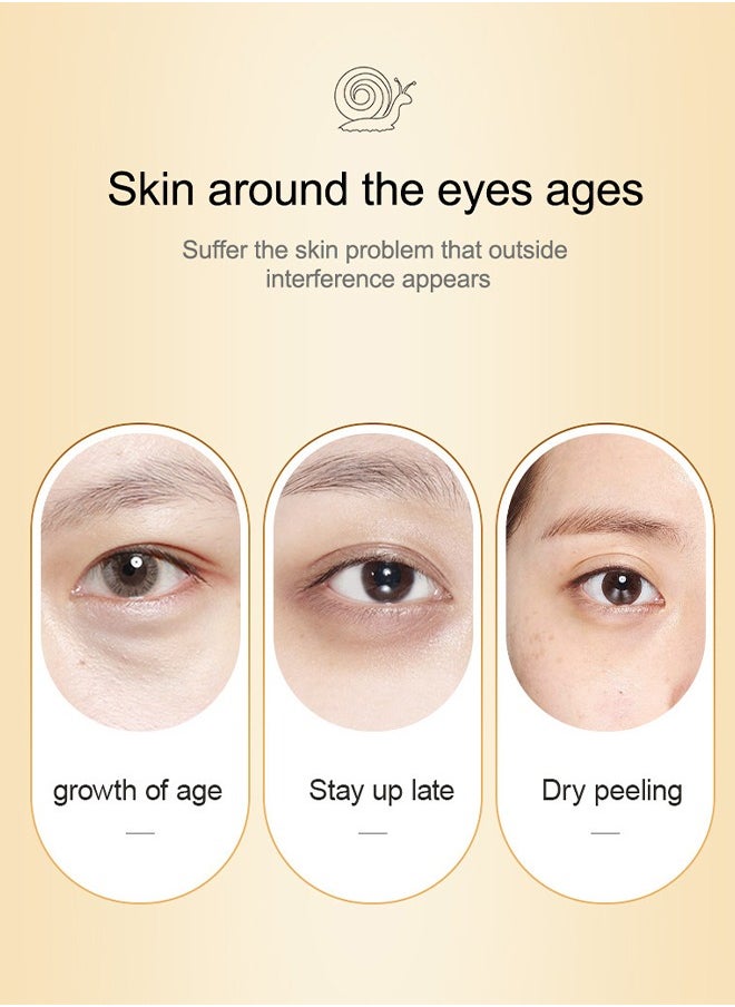 SADOER - Snail Essence Moisturize Eye Cream 20g, Anti Aging, Exquisitely Repair Skin, Moisturize, Fade Eye Lines, Dark Circles and Black Spots, Shrink Pores and Tighten Skin, Moisturizing Eye Serum, Eye Care - Image 1