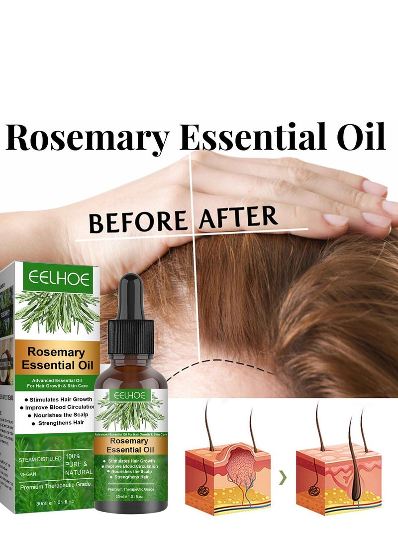 EELHOE 2 pcs Rosemary Hair Care Essential Oil - Image 4