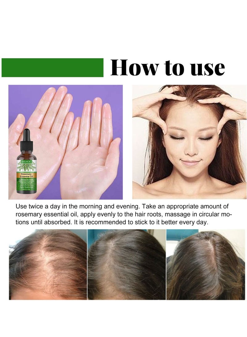 EELHOE 2 pcs Rosemary Hair Care Essential Oil - Image 5