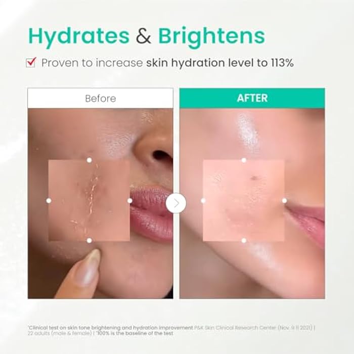 Dr. G Brightening Peeling Gel - Korean Skincare for Glowy Skin - Aqua Gommage Facial Exfoliator - Hyaluronic Acid, Ceramides, Vitamin C - Smooth Skin Texture, Low Irritation - Bulk Items - 4.23 fl oz - Image 4