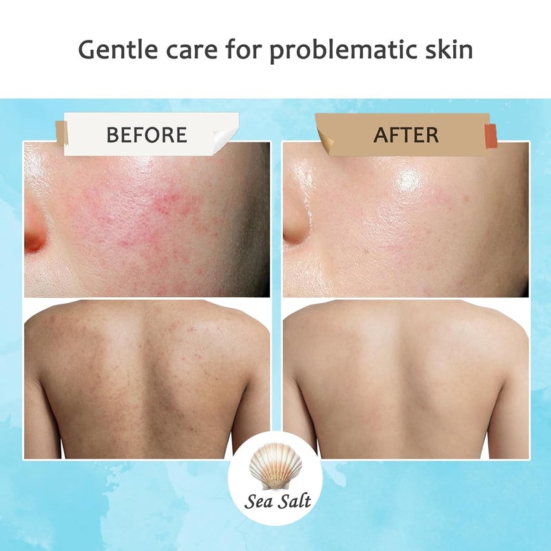 Fusang 3PCS Goat Milk Soap BarsMoisturizing Body Bar Soap for Men and WomenGentle Organic Goat Milk SoapsLong Lasting Nourishing Face and Body Wash Bar for All Skin Types - Image 4