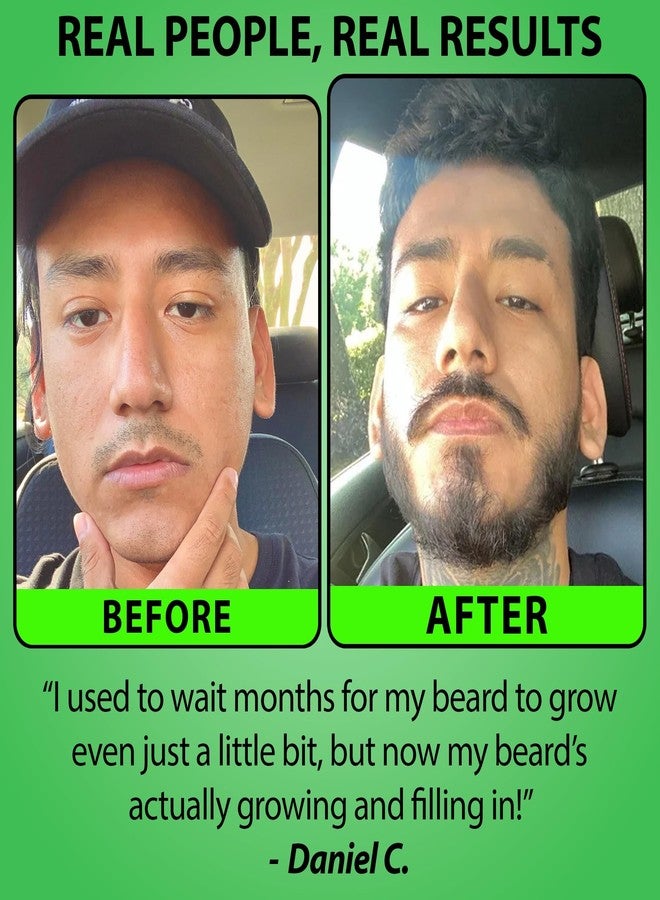 BBS BEST BEARD STUFF Minoxidil for Beard Growth – 5% Serum with 2X Biotin & Rice Water, Promotes Thicker, Fuller Facial Hair, Ideal for Patchy Areas, Revitalizes Follicles - Image 3