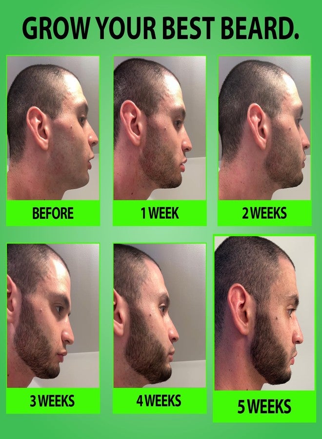 BBS BEST BEARD STUFF Minoxidil for Beard Growth – 5% Serum with 2X Biotin & Rice Water, Promotes Thicker, Fuller Facial Hair, Ideal for Patchy Areas, Revitalizes Follicles - Image 4