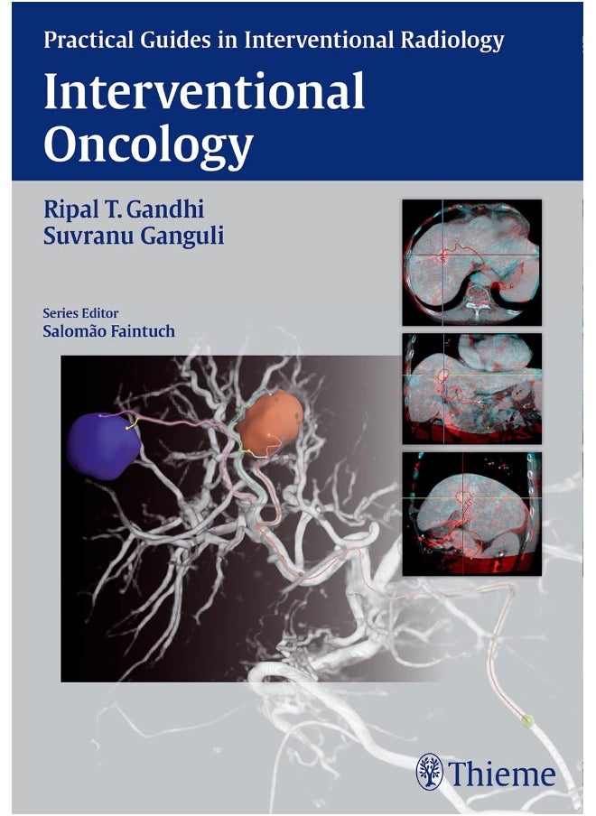 Interventional Oncology 