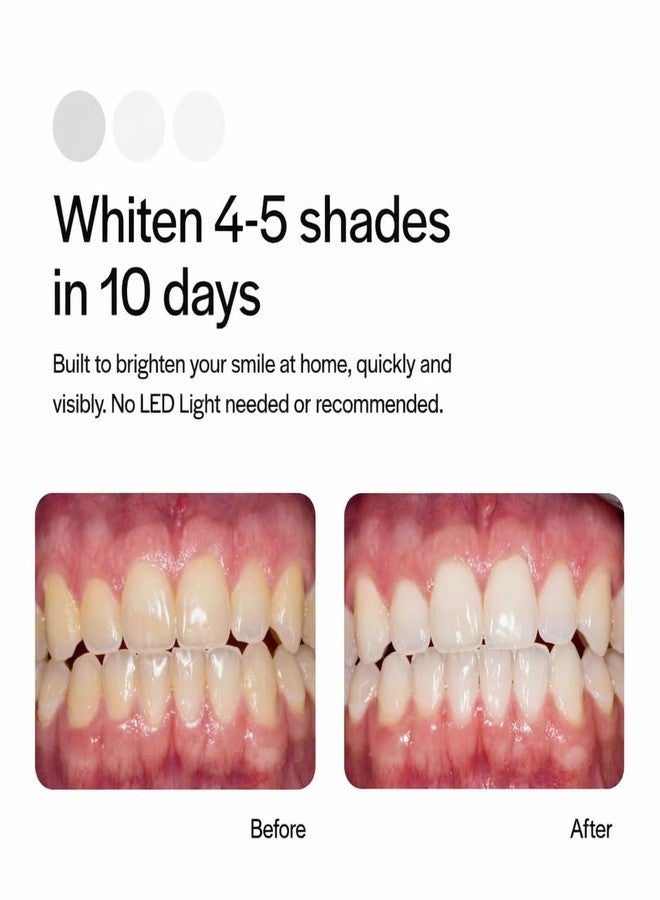 Opalescence Go 10% Whitening Bundle Prefilled Gel Whitening Trays - (10 Treatments Hydrogen Peroxide 10% - Includes Opalescence Whitening Toothpaste. Teeth Whitening Kit -Mint- 5194-5166 - Image 2