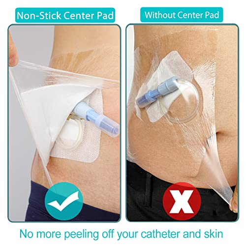 DiaBelt Waterproof Dialysis Catheter Shower Cover PD Catheter Shower Protector Shields with Non-Stick Center Pad for Peritoneal Dialysis Accessories Port Chest Central Line 6"x6" Pack of 25 - Image 5
