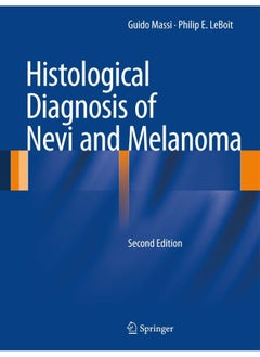 Histological Diagnosis of Nevi and Melanoma 