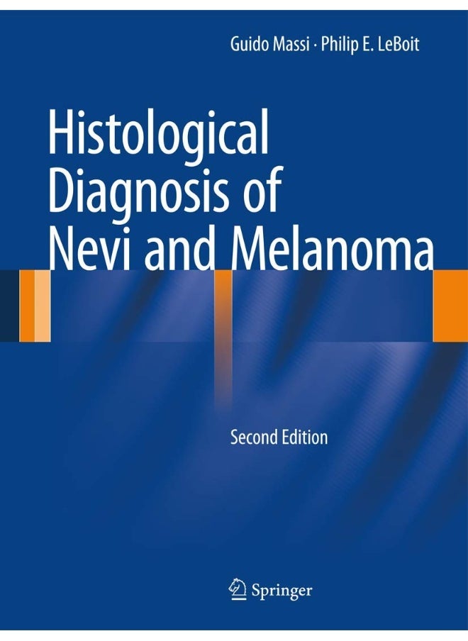 Histological Diagnosis of Nevi and Melanoma 