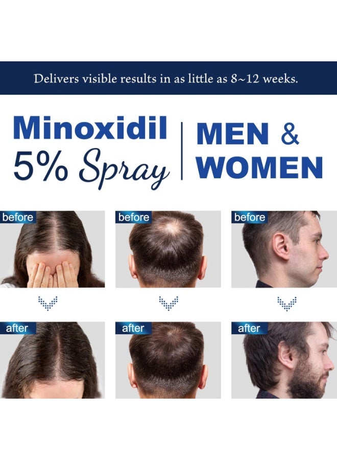 HOEGOA Minoxidil 5% for Men (120 ML), Advanced Minoxidil Spray with Provitamin B5 and Castor Seed Extract, Minoxidil Extract Serum for Hair Loss, Beard Restoration - Image 2