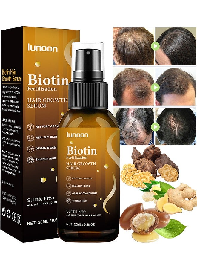 LUNOON Biotin Hair Growth Serum, Hair Regrowth Spray, Biotin Thickening Herbal Serum, Anti Hair Loss Serum For Hair Growth And Hair Loss, Hair Regrowth For Thicker Longer Fuller Hair, 20ML - Image 1