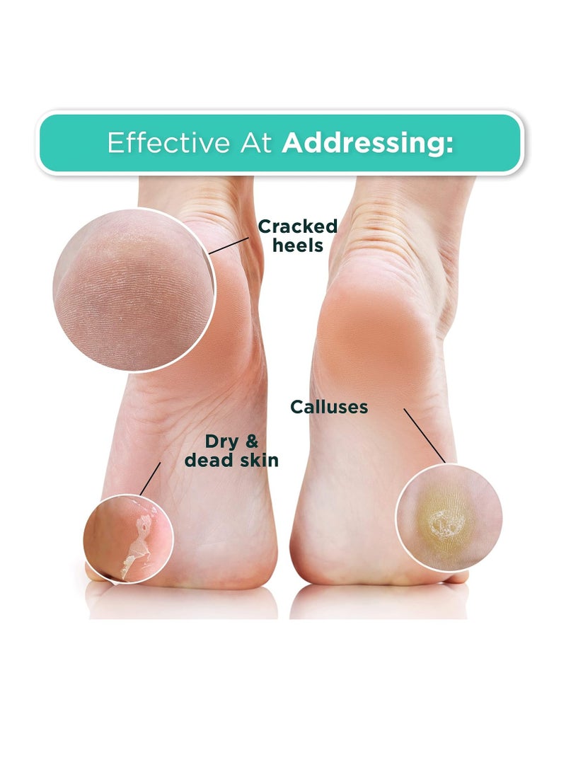 Dermora Dermora Foot Peel Mask - 2 Pack of Regular Skin Exfoliating Foot Masks for Dry, Cracked Feet, Callus, Dead Skin Remover - Feet Peeling Mask for Soft Baby Feet, Original Scent  - Image 4