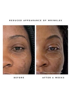 HERBIVORE HERBIVORE Bakuchiol Retinol Alternative - Bakuchiol + Peptides, Smooths Skin, Reduces Fine Lines, Wrinkles & Puffiness, Plant-based, Vegan, Cruelty-free  - Image 5