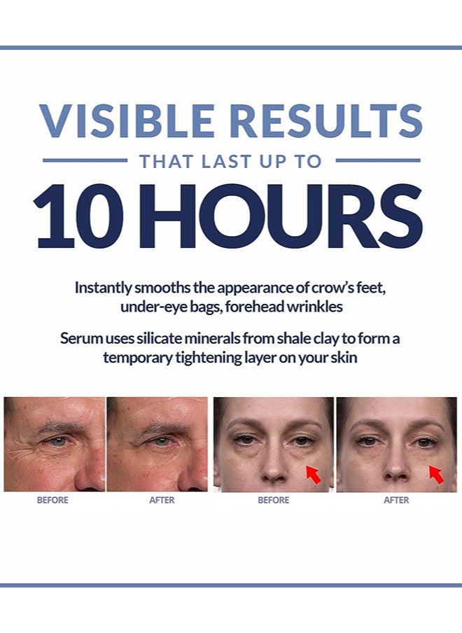 Plexaderm - Rapid Reduction Eye Serum,Visibly Reduces Under-Eye Bags And Wrinkles 0.17 Fl Oz - Image 1