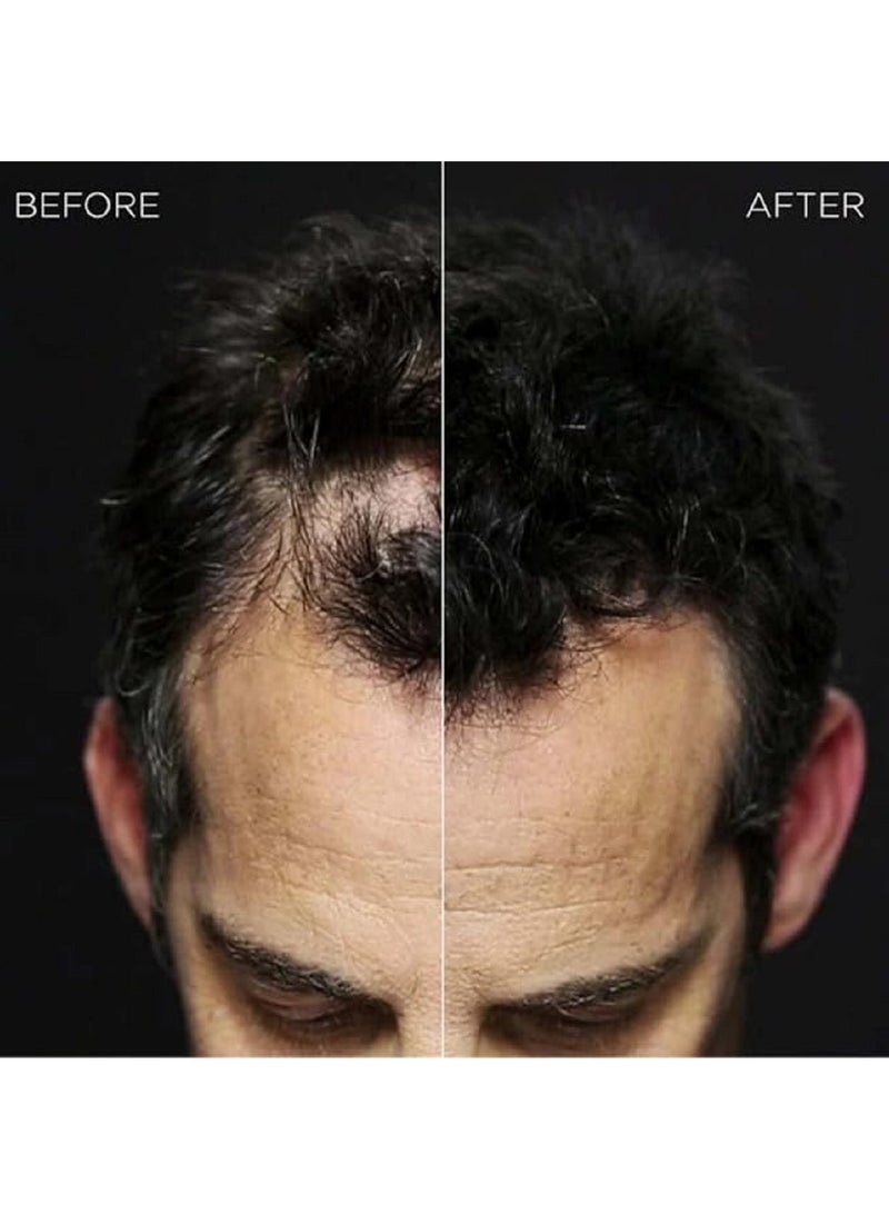 Toppik Hair Building Fibers Dark Brown Color - Image 5