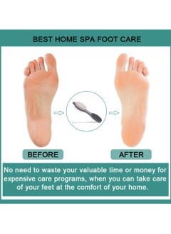 KHAJUL Foot File Callus Remover, Multi Purpose Feet Pedicure Tools with Foot Scrubber, 4 in 1 Pumice Stone, Foot Rasp and Sand Paper for Home (Grey)  - Image 4