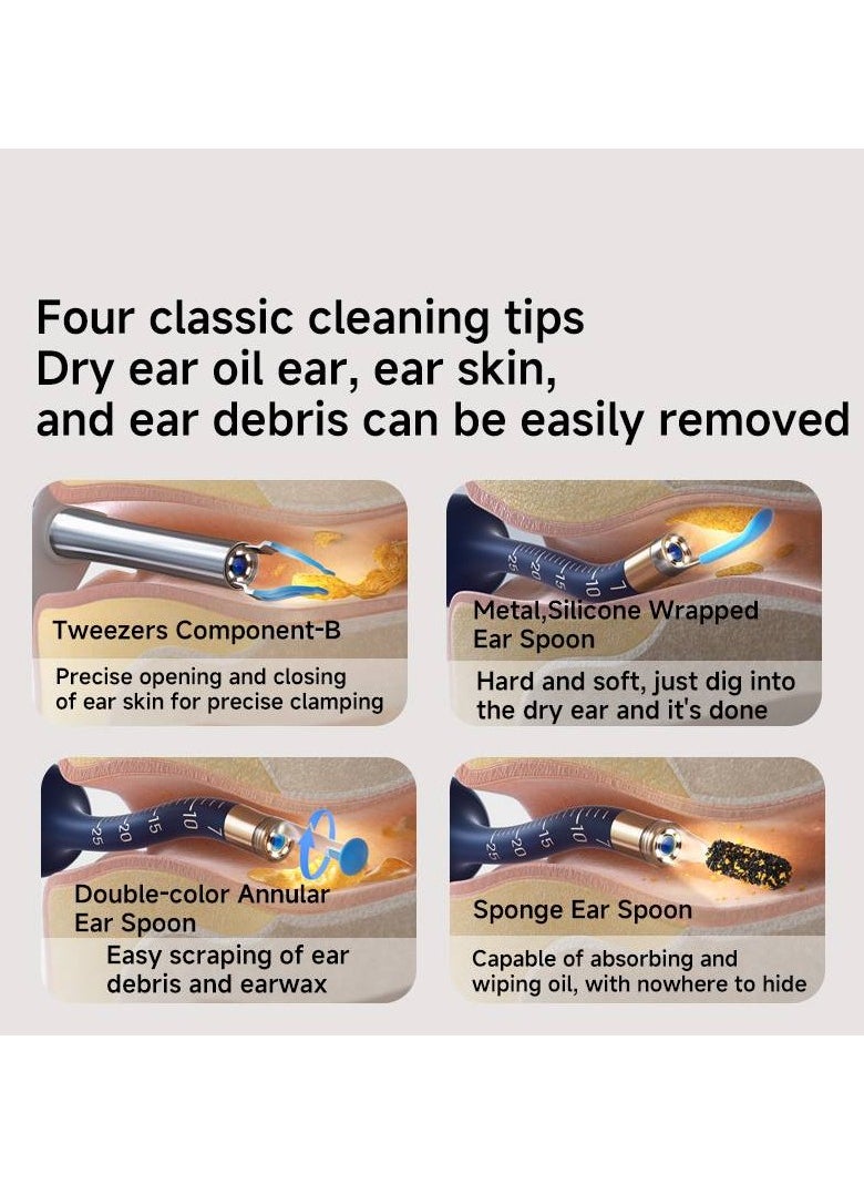 Bebird - BEBIRD Earsight Plus Ear Wax Removal Tool Camera & Light, Visual Earwax Cleaner with Cleaning Kit As Spade/Spoon/Picker/Tweezers Clean Ears for Family, Ear-Scope Wireless WiFi Connect (Dark Blue) - Image 1