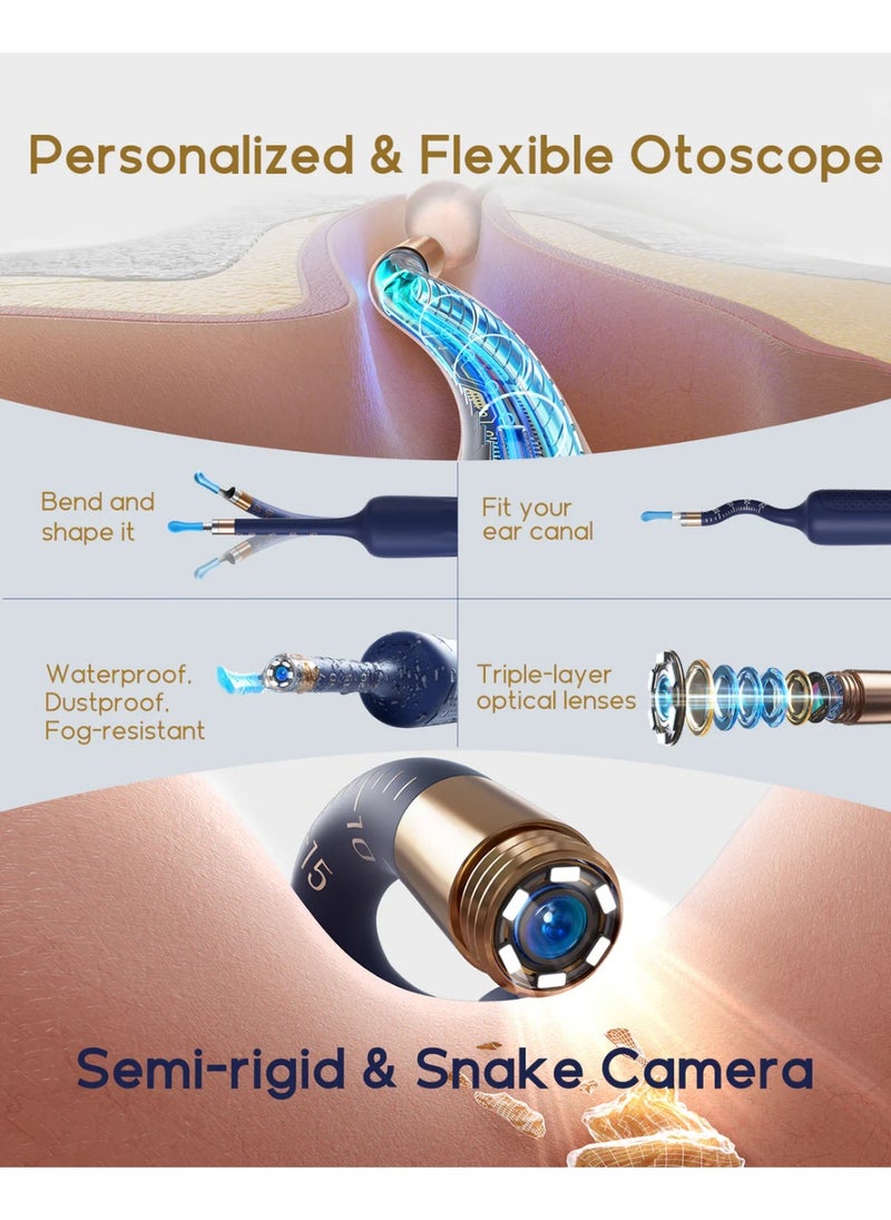 Bebird - BEBIRD Earsight Plus Ear Wax Removal Tool Camera & Light, Visual Earwax Cleaner with Cleaning Kit As Spade/Spoon/Picker/Tweezers Clean Ears for Family, Ear-Scope Wireless WiFi Connect (Dark Blue) - Image 1