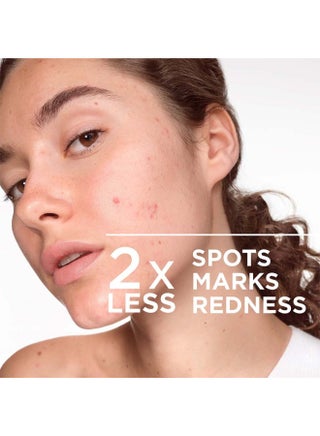 Sebium Kerato + Gel-Creaam For Acne-Prone Skin 30ml - view 5