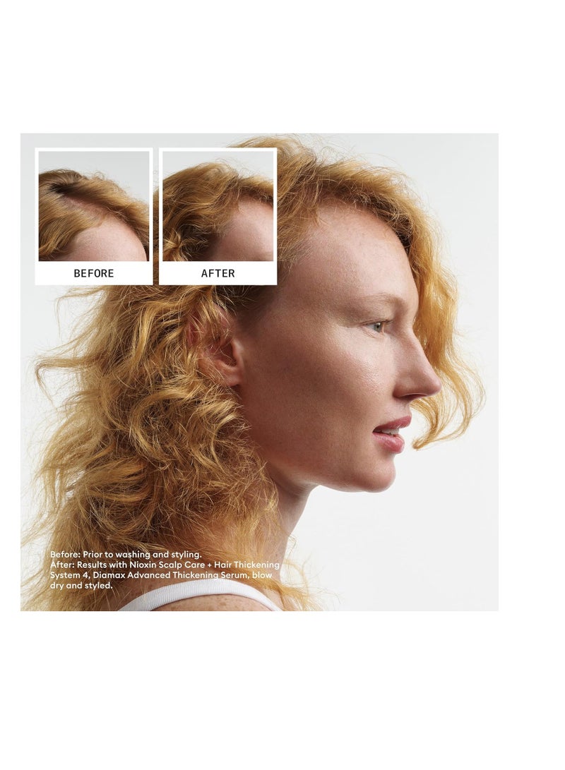 Nioxin Scalp + Hair Thickening System 4 | For Colored or Damaged Hair with Progressed Thinning| With Niacinamide and Biotin | Trial Size | 1 Month Supply - Image 1
