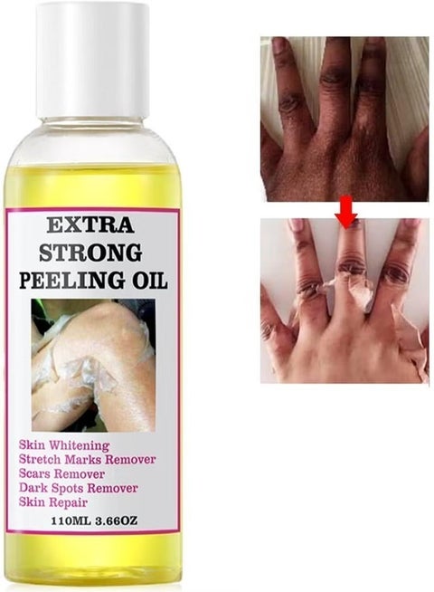 Yellow Peeling Oil 110ml Super Strength Dead Skin Remover Extra Strong Exfoliating Chemical Exfoliant Peeling Oil Skin Moisturizing Hydrating Butter Peeling Skin Whitening Peeling Solution for Dull Skin and Uneven Skin Tone for Body Hand Foot Knuckle All Skin Type