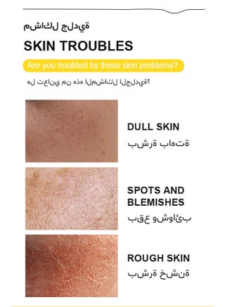 Yellow Peeling Oil 110ml Super Strength Dead Skin Remover Extra Strong Exfoliating Chemical Exfoliant Peeling Oil Skin Moisturizing Hydrating Butter Peeling Skin Whitening Peeling Solution for Dull Skin and Uneven Skin Tone for Body Hand Foot Knuckle All Skin Type - view 3