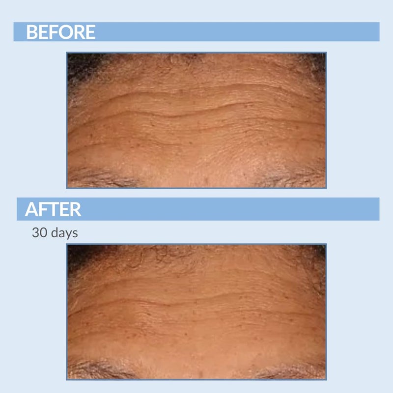 Serious Skincare Retinol Fine Lines and Wrinkles Skin Care Set A Force XR Serum and A Cream XR Moisture Cream for Face AntiAging Minimize Post Acne Marks Resurface and Hydrate Serious Skincare - Image 4