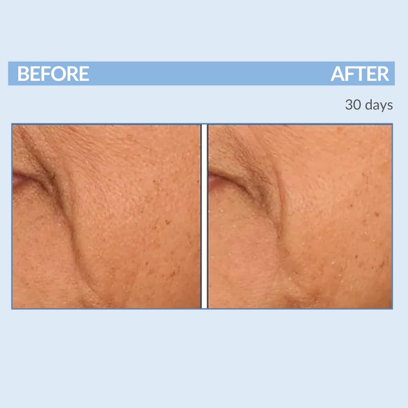 Serious Skincare Retinol Fine Lines and Wrinkles Skin Care Set A Force XR Serum and A Cream XR Moisture Cream for Face AntiAging Minimize Post Acne Marks Resurface and Hydrate Serious Skincare - Image 5